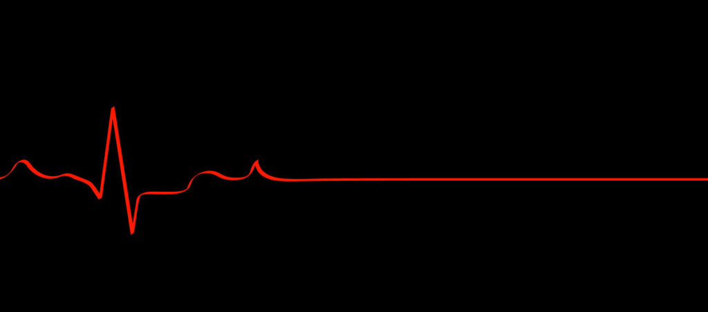 A photo of a heart monitor that is going into a straight line.